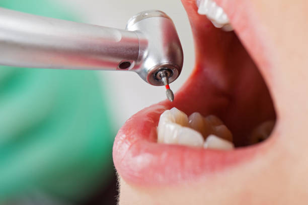 Best Weekend Emergency Dentist in Plafield, IN